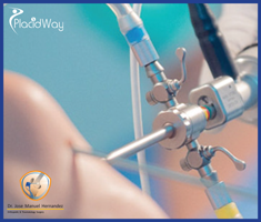 Slider image (4) Orthopedic Surgery in Puerto Vallarta